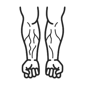 rodellar-forearm-pumped